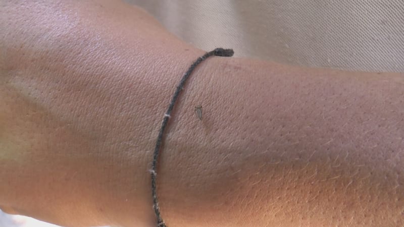 Invazivní druhy komárů vtrhly i do Česka. Po Evropě šíří tropické nemoci